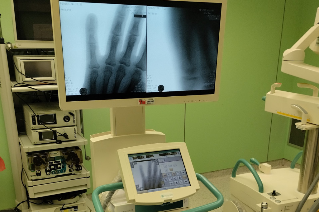 Nowy aparat RTG z ramieniem C na sali operacyjnej SPZOZ Gostyń