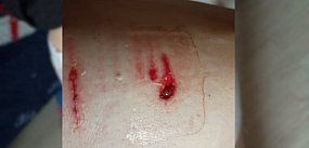 Krzyk, szarpanina i wizyta w szpitalu! Wybiegł nagle...