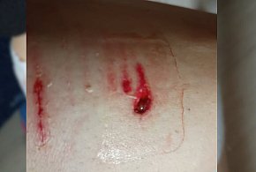 Krzyk, szarpanina i wizyta w szpitalu! Wybiegł nagle i zaatakował. Sprawą...