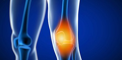 Endoproteza kolana - kiedy jest potrzebna i jak wygląda leczenie?