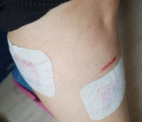 Krzyk, szarpanina i wizyta w szpitalu! Wybiegł nagle i zaatakował. Sprawą...