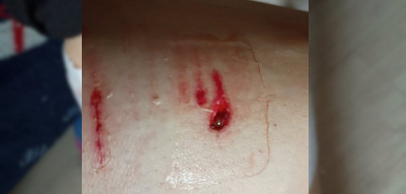 Krzyk, szarpanina i wizyta w szpitalu! Wybiegł nagle i zaatakował. Sprawą...