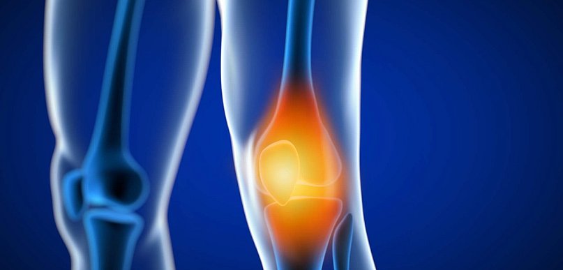 Endoproteza kolana - kiedy jest potrzebna i jak wygląda leczenie?