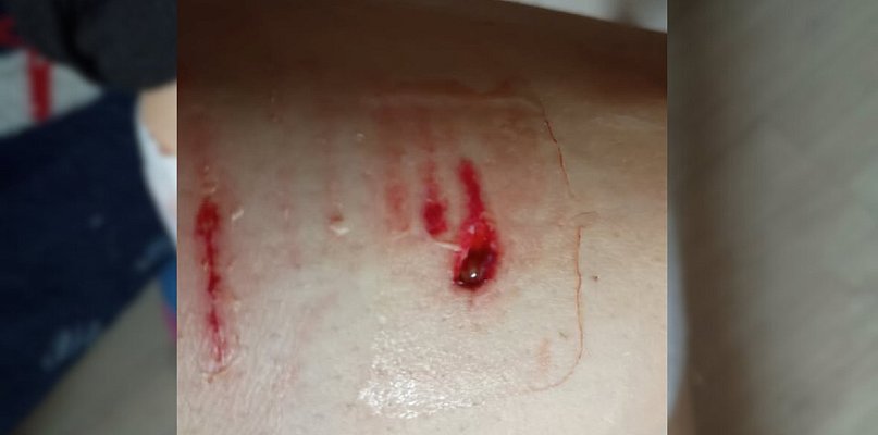 Krzyk, szarpanina i wizyta w szpitalu! Wybiegł nagle i zaatakował. Sprawą...